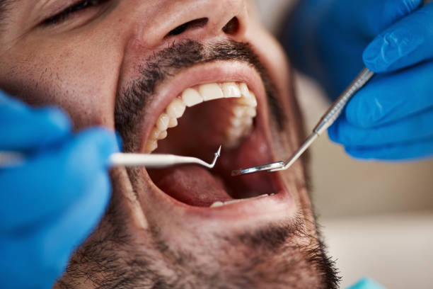 Best Knocked-Out Tooth Emergency  in Rutledge, GA